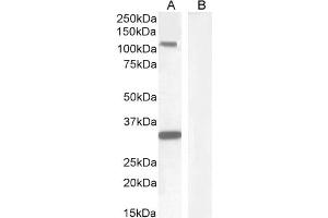 Western Blotting (WB) image for anti-Mast/stem Cell Growth Factor Receptor (KIT) (Internal Region) antibody (ABIN1589992)