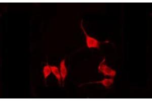 ABIN6274828 staining COLO205 by IF/ICC. (AKR1C2 抗体  (N-Term))