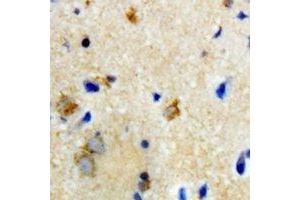 Immunohistochemical analysis of Biotinidase staining in rat brain formalin fixed paraffin embedded tissue section. (BTD 抗体)