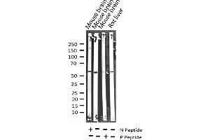 Western blot analysis of Phospho-GABA-RB (Ser434) expression in various lysates (GABA-RB (pSer434) 抗体)