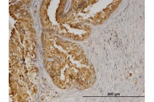Immunostaining (ISt) image for anti-Angiotensin II Receptor-Associated Protein (AGTRAP) (AA 108-159) antibody (ABIN566082)