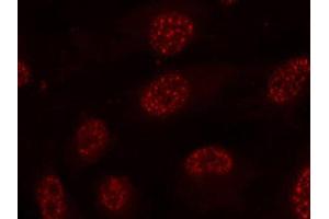 Immunofluorescence staining of methanol-fixed Hela cells using Phospho-MAPKAPK2-T334 antibody.