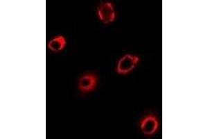 Immunofluorescent analysis of PCMT1 staining in Hela cells. (PCMT1 抗体)