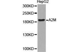 Western Blotting (WB) image for anti-alpha-2-Macroglobulin (A2M) antibody (ABIN1870709) (alpha 2 Macroglobulin 抗体)
