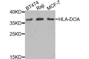 Western blot analysis of extracts of various cells, using HLA-DOA antibody. (HLA-DOA 抗体)