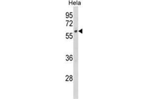 Western blot analysis of CYP7B1 Antibody (Center) in Hela cell line lysates (35ug/lane). (CYP7B1 抗体  (Middle Region))