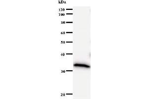 Western Blotting (WB) image for anti-DNA (Cytosine-5-)-Methyltransferase 3 beta (DNMT3B) antibody (ABIN933161) (DNMT3B 抗体)