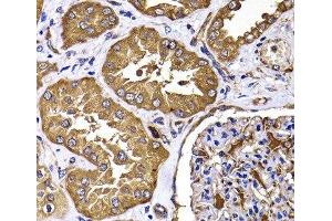 Immunohistochemistry of paraffin-embedded Human kidney using TGS1 Polyclonal Antibody at dilution of 1:100 (40x lens). (TGS1 抗体)