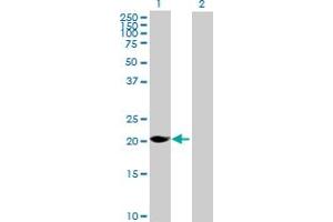 Western Blot analysis of MAGEH1 expression in transfected 293T cell line by MAGEH1 MaxPab polyclonal antibody. (MAGEH1 抗体  (AA 1-219))