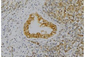 ABIN6277560 at 1/100 staining Human uterus tissue by IHC-P. (WIF1 抗体  (Internal Region))