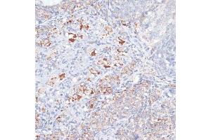 Immunohistochemistry of paraffin-embedded rat ovary using SMPD1 antibody. (SMPD1 抗体  (AA 70-340))