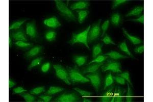 Immunofluorescence of monoclonal antibody to MKNK1 on HeLa cell. (MKNK1 抗体  (AA 1-465))