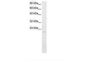Image no. 1 for anti-SP140 Nuclear Body Protein (SP140) (AA 39-88) antibody (ABIN202038) (SP140 抗体  (AA 39-88))