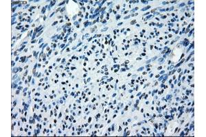 Immunohistochemical staining of paraffin-embedded endometrium tissue using anti-SATB1mouse monoclonal antibody. (SATB1 抗体)