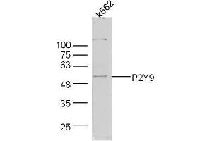 Human k562 lysates probed with Rabbit Anti-P2Y9 Polyclonal Antibody, Unconjugated  at 1:300 overnight at 4˚C. (LPAR4 抗体  (AA 175-270))