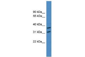 WB Suggested Anti-OTUD6A Antibody Titration: 0. (OTUD6A 抗体  (N-Term))