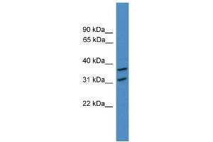 WB Suggested Anti-OTUD6A Antibody Titration: 0. (OTUD6A 抗体  (N-Term))