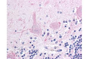 Anti-AFF1 antibody IHC of human brain, cerebellum. (AF4 抗体  (AA 1190-1203))