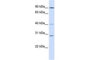 Image no. 1 for anti-Excision Repair Cross-Complementing Rodent Repair Deficiency, Complementation Group 2 (ERCC2) (N-Term) antibody (ABIN6744385) (ERCC2 抗体  (N-Term))