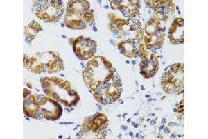 Immunohistochemistry of paraffin-embedded Human stomach using RIPK4 Polyclonal Antibody at dilution of 1:100 (40x lens). (RIPK4 抗体)