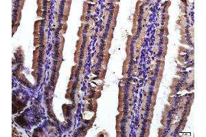 Paraformaldehyde-fixed, paraffin embedded mouse intestine, Antigen retrieval by boiling in sodium citrate buffer (pH6. (CD9 抗体  (AA 101-200))