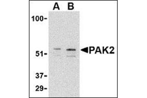 Western blot analysis of PAK2 in Jurkat lysate with this product at (A) 0.