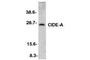 Western blot analysis of CIDE-A in murine heart tissue lysate with CIDE-A antibody at 2ug/ml. (CIDEA 抗体  (AA 200-214))