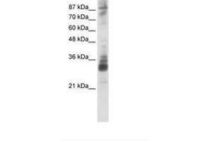 RG9MTD2 antibody  (AA 181-230)