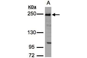 WB Image Sample(30 ug whole cell lysate) A:H1299 5% SDS PAGE antibody diluted at 1:3000 (TJP1 抗体  (N-Term))