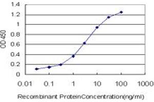 Detection limit for recombinant GST tagged GRK4 is approximately 0. (GRK4 抗体  (AA 36-145))