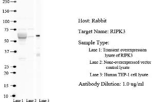 Western Blotting (WB) image for anti-Receptor-Interacting serine-threonine Kinase 3 (RIPK3) (N-Term) antibody (ABIN2777333)