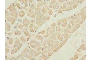 Immunohistochemistry of paraffin-embedded human heart tissue using ABIN7163881 at dilution of 1:100 (GALNT2 抗体  (AA 442-571))