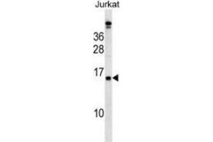 Western blot analysis in Jurkat cell line lysates (35ug/lane) using PLAC4  Antibody . (PLAC4 抗体  (N-Term))