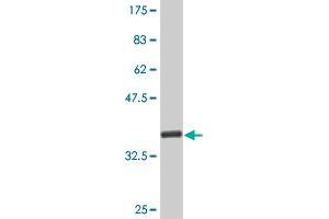 Western Blot detection against Immunogen (35. (CDK4 抗体  (AA 211-303))