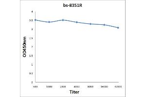 Antigen: 2 µg/100 µL  Primary: Antiserum, 1:500, 1:1000, 1:2000, 1:4000, 1:8000, 1:16000, 1:32000;  Secondary: HRP conjugated Rabbit Anti-Goat IgG at 1: 5000;  TMB staining Read the data in Microplate Reader by 450nm. (UBE2N 抗体  (AA 56-152))