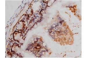 ABIN6267362 at 1/200 staining Mouse intestinal tissue sections by IHC-P. (MAPT 抗体  (pThr205))