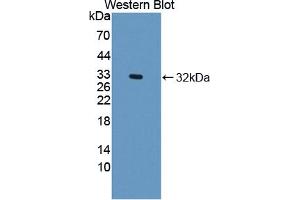 Western blot analysis of the recombinant protein. (DOCK2 抗体  (AA 390-635))