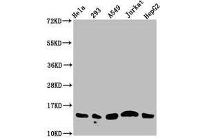 Western Blot Positive WB detected in: Hela whole cell lysate, 293 whole cell lysate, A549 whole cell lysate, Jurkat whole cell lysate, HepG2 whole cell lysate (all treated with 30 mM sodium butyrate for 4h) All lanes: HIST1H2AG antibody at 1. (HIST1H2AG 抗体  (acLys13))