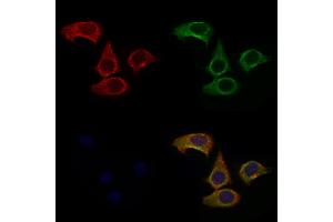 ABIN6257652 and ABIN6275247 staining Hela cells by IF/ICC. (TOMM20 抗体  (Internal Region))
