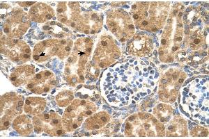 Human kidney (PTGDS 抗体  (N-Term))