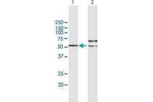 Western Blot analysis of TUBB4Q expression in transfected 293T cell line by TUBB4Q MaxPab polyclonal antibody. (TUBB7P 抗体  (AA 1-434))