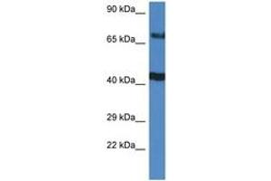 Image no. 1 for anti-TNFAIP3 Interacting Protein 1 (TNIP1) (C-Term) antibody (ABIN6747407)