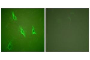 Immunofluorescence analysis of HeLa cells, using Caspase 10 antibody. (Caspase 10 抗体  (C-Term))