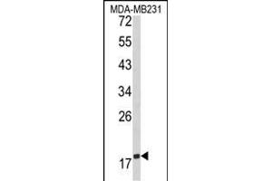 Western blot analysis of CD28 Antibody (C-term) (ABIN390970 and ABIN2841150) in MDA-M cell line lysates (35 μg/lane). (CD28 抗体  (C-Term))