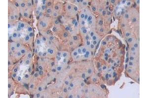 Detection of LCNL1 in Rat Kidney Tissue using Polyclonal Antibody to Lipocalin Like Protein 1 (LCNL1) (LCNL1 抗体)