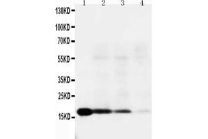 Lane 4: RAJI Cell Lysate (IL-18 抗体  (C-Term))