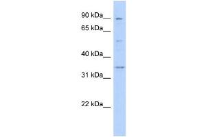 WB Suggested Anti-WNT9B Antibody Titration:  0. (WNT9B 抗体  (Middle Region))