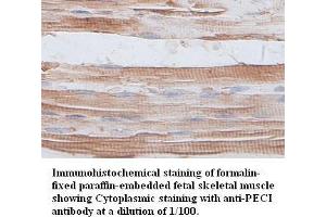 Image no. 1 for anti-Enoyl-CoA Delta Isomerase 2 (PECI) antibody (ABIN791176) (PECI/ECI2 抗体)