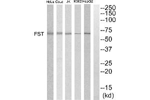 Western blot analysis of extracts from HepG2, K562, COLO205, Jurkat and HeLa cells, using FST antibody. (Follistatin 抗体)