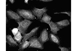 Immunofluorescent staining of HeLa (ATCC CCL-2) cells. (Paxillin 抗体  (AA 1-557))